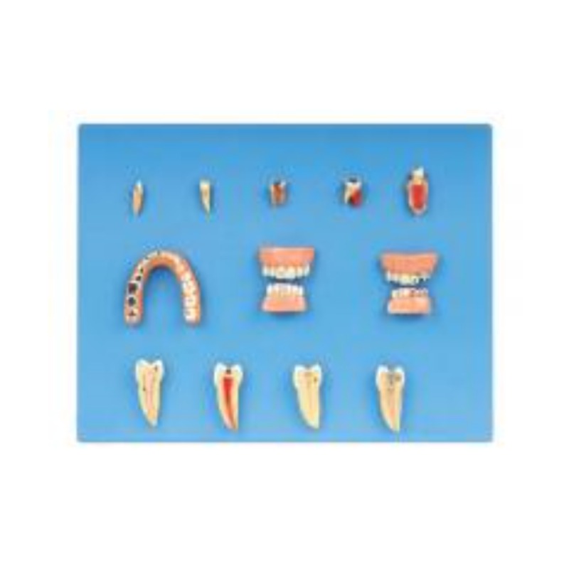 牙齿病变系列模型实训考核装置  牙齿病变系列模型实训设备 牙齿病变系列模型综合实训台图片