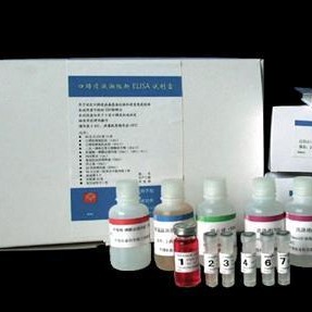 人抗肝细胞胞质1型抗体试剂盒 LC1试剂盒 抗肝细胞胞质1型抗体ELISA试剂盒 厂家直销图片